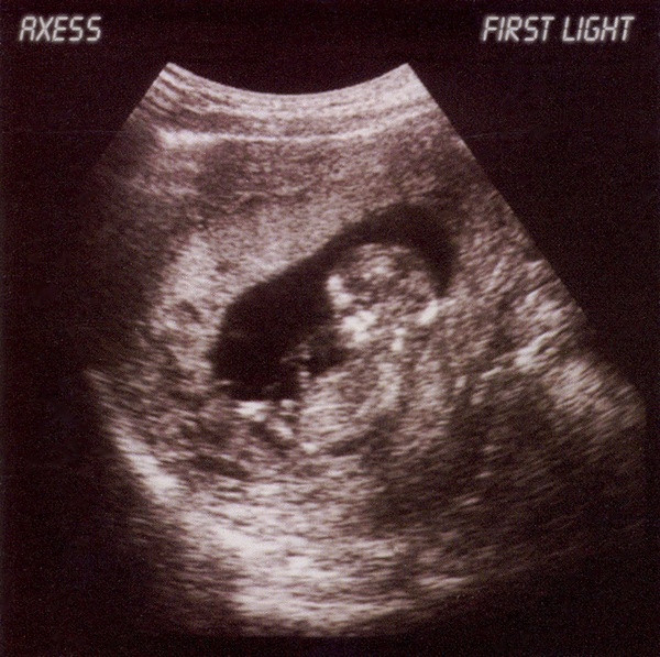 Axess - First Light